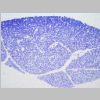 Pancreas SF 21.jpg